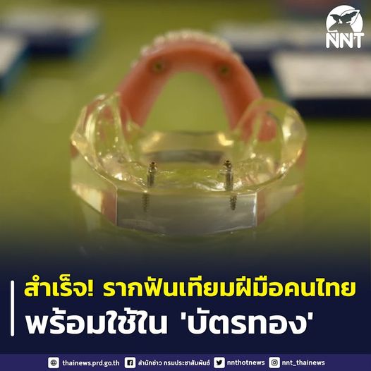 รากฟันเทียมฝีมือคนไทย ถูกกว่านำเข้ากว่า 10 เท่า พร้อมใช้รักษาผู้สูงวัยสิทธิบัตรทอง